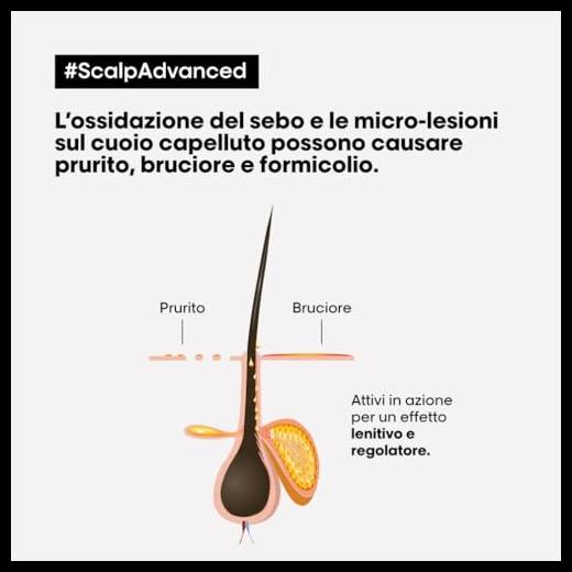 L'Oréal Professionnel Paris Shampoo Lenitivo, Per Cuoio Capelluto Sensibile, Per Capelli Luminosi e Setosi, Con Niacinamide, Anti-Discomfort, Scalp Advanced, 500 ml